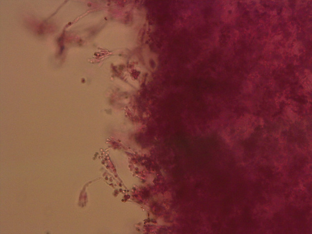 Penicillium Slides - Penicillium 02 400X